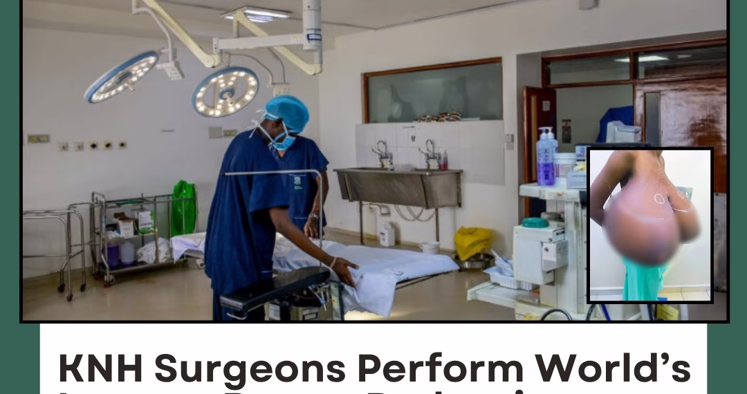 KNH Surgeons Perform World’s Largest Breast Reduction on 17-Year-Old Girl