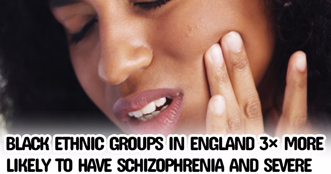 Black Ethnic Groups in England 3× More Likely to Have Schizophrenia and Severe Mental Illness: UK Official Data Reveals