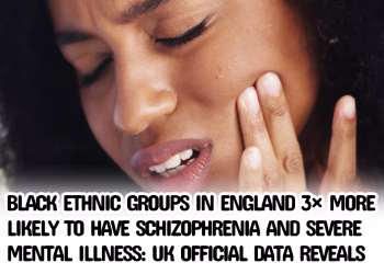 Black Ethnic Groups in England 3× More Likely to Have Schizophrenia and Severe Mental Illness: UK Official Data Reveals