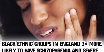Black Ethnic Groups in England 3× More Likely to Have Schizophrenia and Severe Mental Illness: UK Official Data Reveals